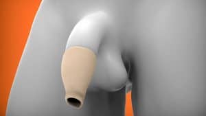 Oxballs foreskin sleeve